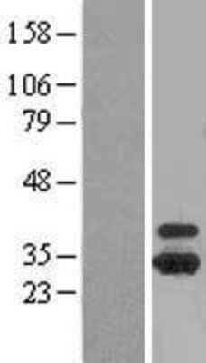 Western Blot: Otubain-1 Overexpression Lysate [NBL1-14011]