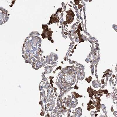 Immunohistochemistry-Paraffin: OTUD1 Antibody [NBP1-90484]
