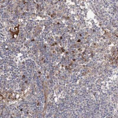 Immunohistochemistry-Paraffin: OTUD1 Antibody [NBP1-90484]