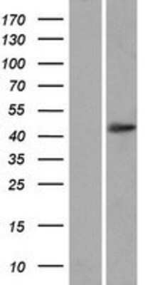 Western Blot: OTUD3 Overexpression Lysate [NBP2-07203]