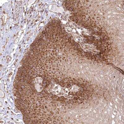 Immunohistochemistry-Paraffin: OTUD4 Antibody [NBP1-84044]