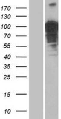 Western Blot: OTUD4 Overexpression Lysate [NBP2-04629]