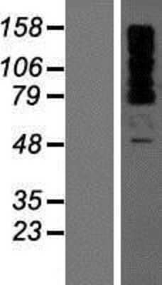 Western Blot: OTUD4 Overexpression Lysate [NBP2-08244]