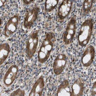 Immunohistochemistry-Paraffin: OTUD5 Antibody [NBP1-85044]