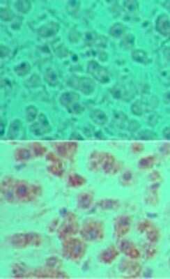Immunohistochemistry-Paraffin: OTUD5 Antibody [NBP2-24634]