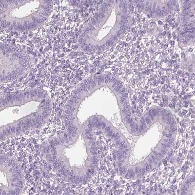 Immunohistochemistry-Paraffin: OTUD6A Antibody [NBP2-49078]