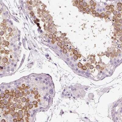 Immunohistochemistry-Paraffin: OTUD6A Antibody [NBP2-49078]