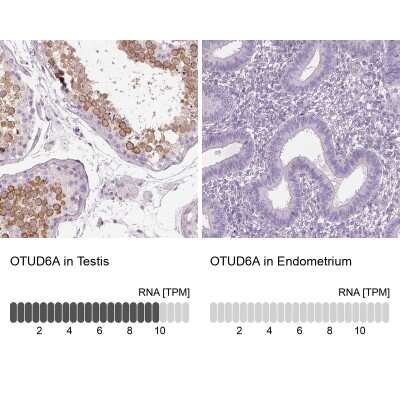 Immunohistochemistry-Paraffin: OTUD6A Antibody [NBP2-49078]