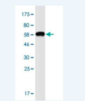 Western Blot: OTUD6B Antibody (3H4) [H00051633-M04-100ug]