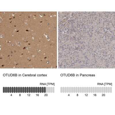 Immunohistochemistry-Paraffin: OTUD6B Antibody [NBP1-85651]