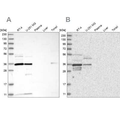 Western Blot: OTUD6B Antibody [NBP1-85651]