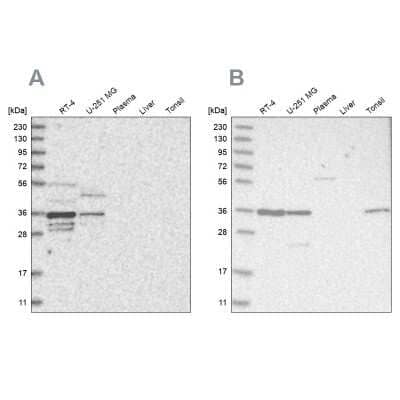 Western Blot: OTUD6B Antibody [NBP1-85653]