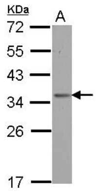 Western Blot: OTUD6B Antibody [NBP2-19644]