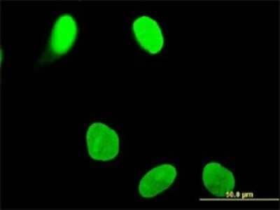 Immunocytochemistry/ Immunofluorescence: OTUD7B/Cezanne/ZA20D1 Antibody (2B4) [H00056957-M01]