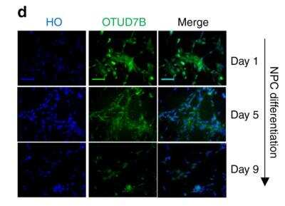 Immunocytochemistry/ Immunofluorescence: OTUD7B/Cezanne/ZA20D1 Antibody [NBP1-88095]