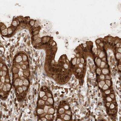 Immunohistochemistry-Paraffin: OTUD7B/Cezanne/ZA20D1 Antibody [NBP1-88095]