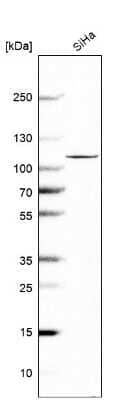 Western Blot: OTUD7B/Cezanne/ZA20D1 Antibody [NBP1-88095]