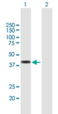 Western Blot: OTX3 Antibody [H00127343-B01P]