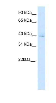 Western Blot: OTX3 Antibody [NBP1-80255]