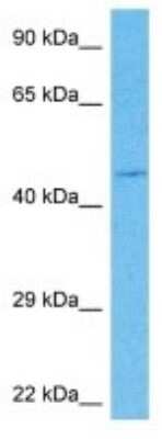 Western Blot: OTX3 Antibody [NBP3-10929]