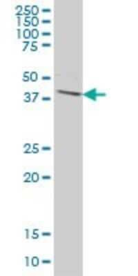 Western Blot: OVCA1 Antibody (2C5) [H00001801-M02]