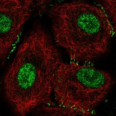 Immunocytochemistry/ Immunofluorescence: OVCA1 Antibody [NBP2-57765]