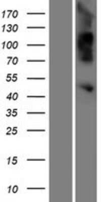 Western Blot: OVCA1 Overexpression Lysate [NBP2-10973]