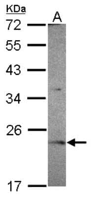 Western Blot: OVCA2 Antibody [NBP2-15058]