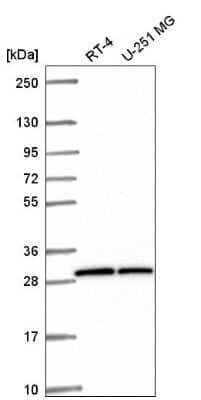 Western Blot: OVCA2 Antibody [NBP2-56767]