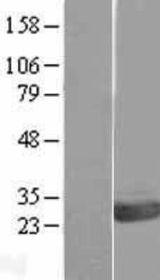 Western Blot: OVCA2 Overexpression Lysate [NBL1-14016]