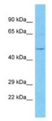 Western Blot: OVCH2 Antibody [NBP3-09873]