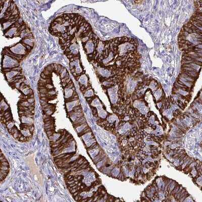 Immunohistochemistry-Paraffin: OVGP1 Antibody [NBP2-32357]