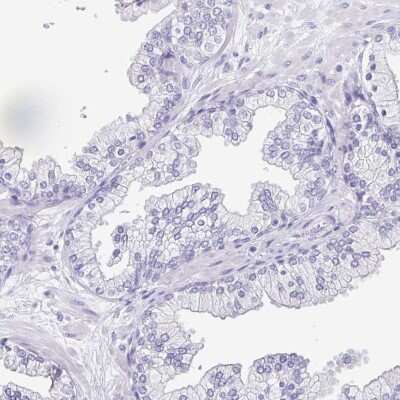 Immunohistochemistry-Paraffin: OVGP1 Antibody [NBP2-32357]