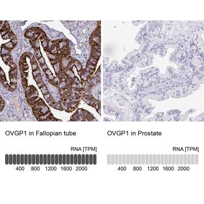 Immunohistochemistry-Paraffin: OVGP1 Antibody [NBP2-32357]