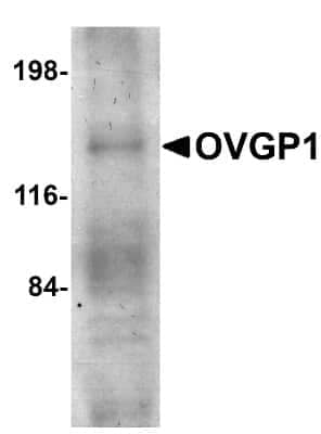 Western Blot: OVGP1 AntibodyBSA Free [NBP1-76939]