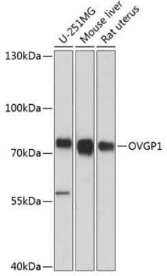 Western Blot: OVGP1 AntibodyAzide and BSA Free [NBP2-94214]