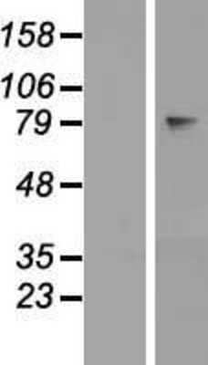 Western Blot: OVGP1 Overexpression Lysate [NBP2-08101]