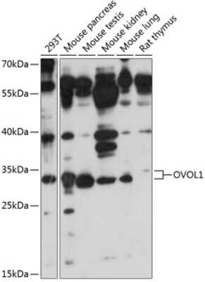 Western Blot: OVOL1 AntibodyAzide and BSA Free [NBP2-93367]