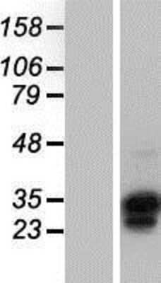 Western Blot: OVOL1 Overexpression Lysate [NBP2-07858]