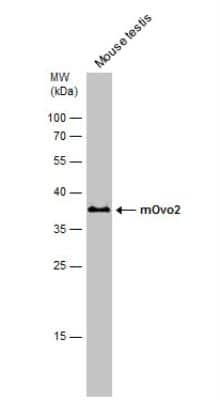 Western Blot: OVOL2 Antibody [NBP2-42907]