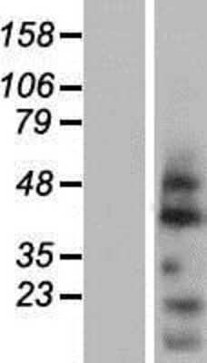 Western Blot: OVOL2 Overexpression Lysate [NBP2-06543]