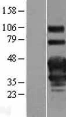 Western Blot: OX40/TNFRSF4 Overexpression Lysate [NBP2-10885]