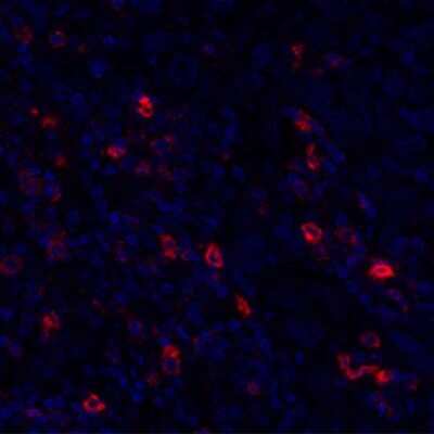 Immunocytochemistry/ Immunofluorescence: OX40/TNFRSF4 Antibody (BLR042F) [NBP2-76421]