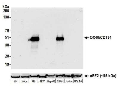 Western Blot: OX40/TNFRSF4 Antibody (BLR042F) [NBP2-76421]