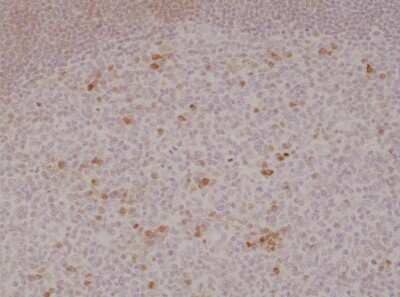 Immunohistochemistry-Paraffin: OX40/TNFRSF4 Antibody (RM313) [NBP2-61570]