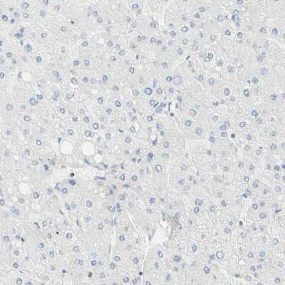 Immunohistochemistry-Paraffin: OXCT1 Antibody [NBP1-82462]