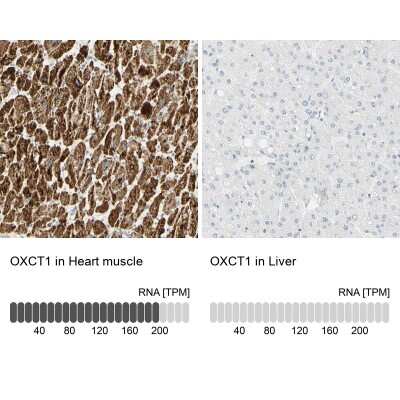 Immunohistochemistry-Paraffin: OXCT1 Antibody [NBP1-82462]