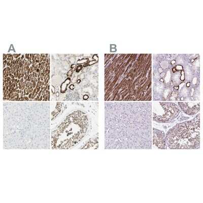 Immunohistochemistry-Paraffin: OXCT1 Antibody [NBP1-82462]