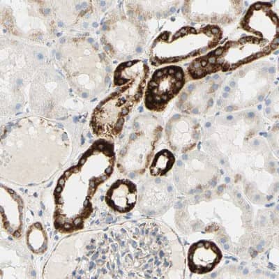 Immunohistochemistry-Paraffin: OXCT1 Antibody [NBP1-82462]