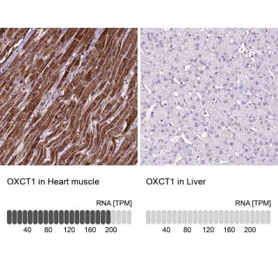 Immunohistochemistry-Paraffin: OXCT1 Antibody [NBP2-49331]